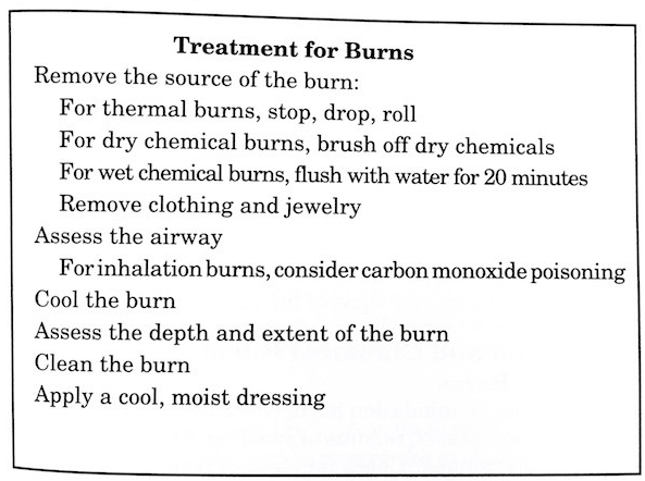 Description of how to treat burns